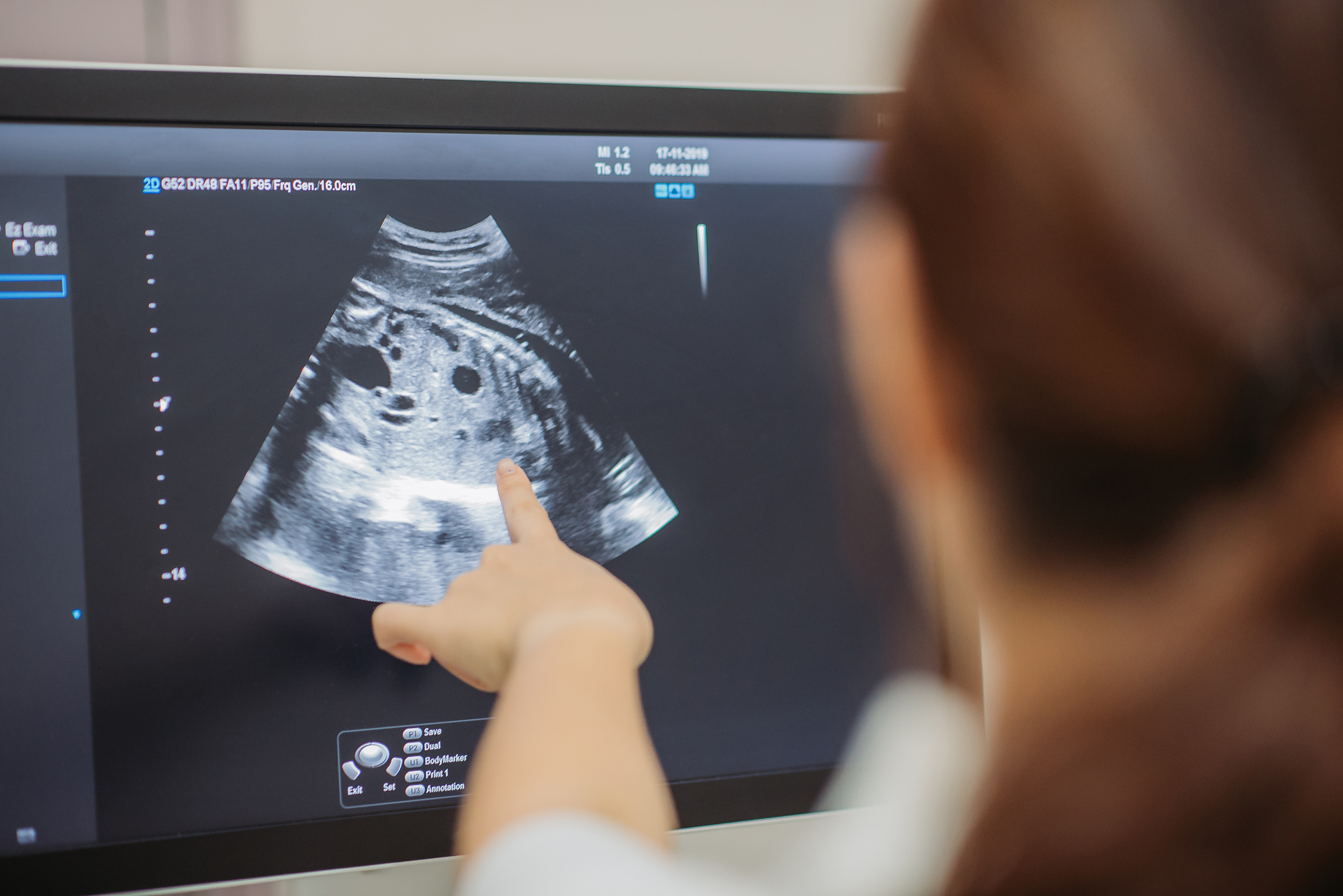  Лекарите наблюдават плацентата на бъдещата майка. Защо 
