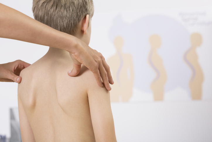 5 признака, че гръбнакът на детето е изкривен 