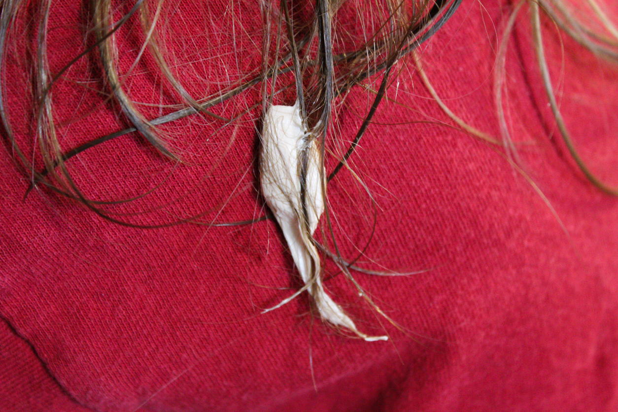 Ужас: дъвка в косата на детето  