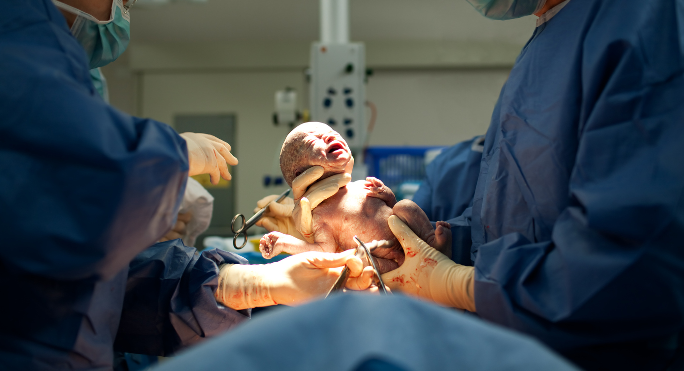 Нов метод за секцио имитира естествено раждане 