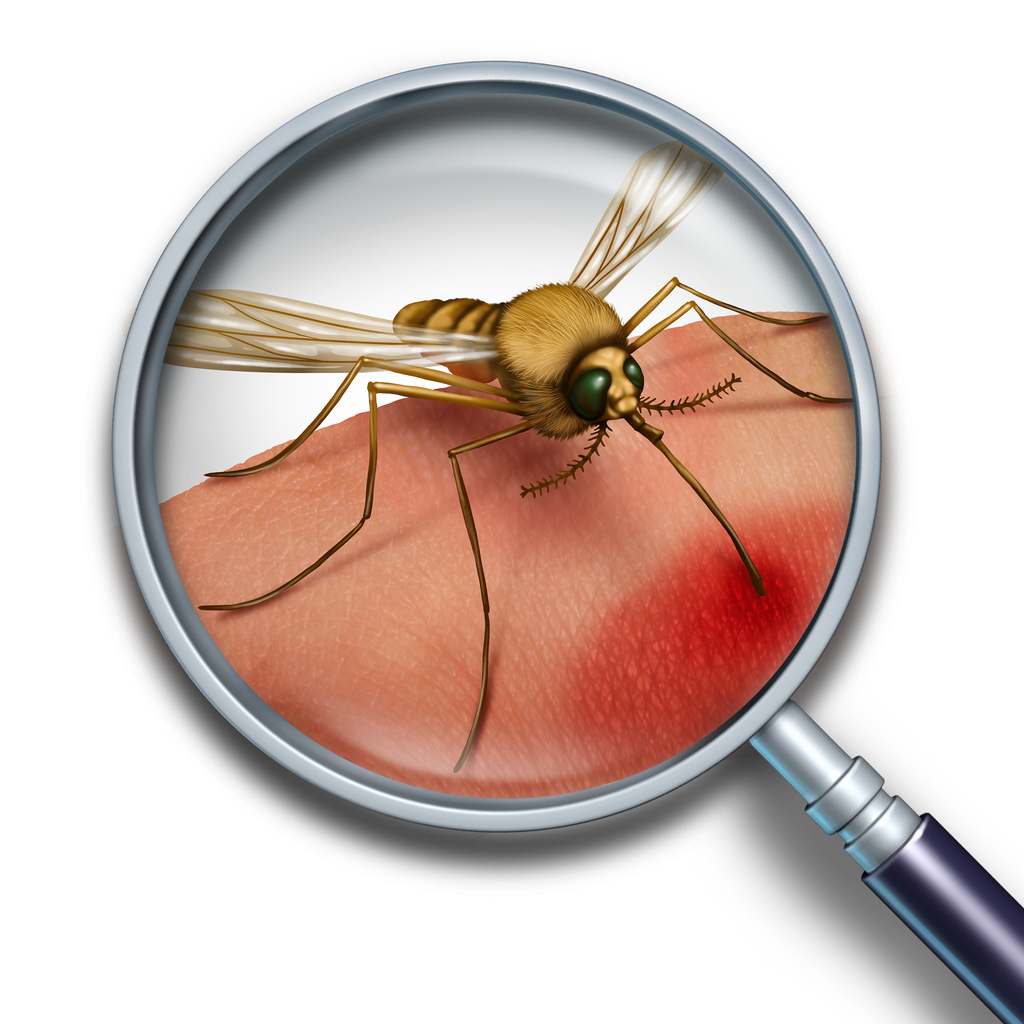 7 природни лека при ухапване от комар 