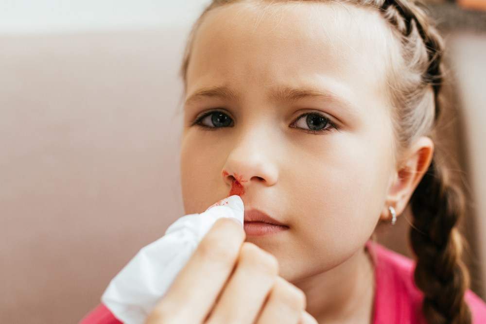 Какво да правим, ако носът на детето започне да кърви