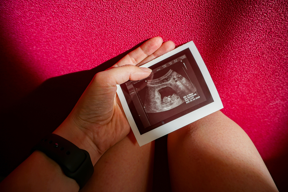 13-та седмица на бременността: Вече сте във второто тримесечие! 