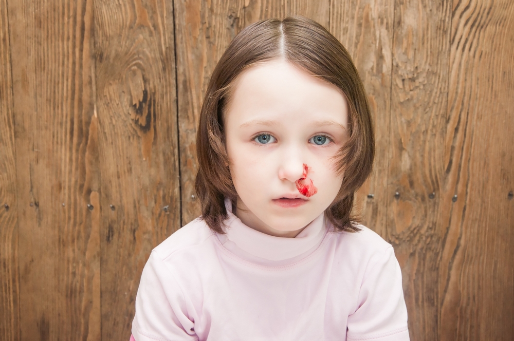 Какво да правим, ако носът на детето започне да кърви 