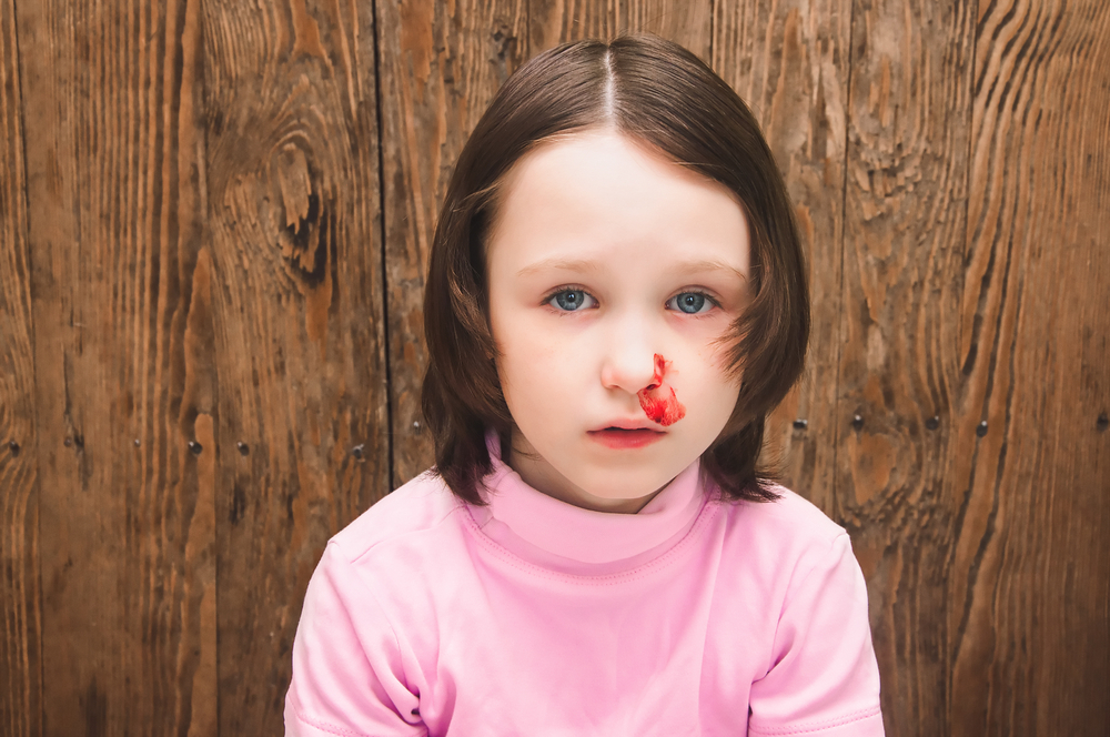 Носът на детето кърви